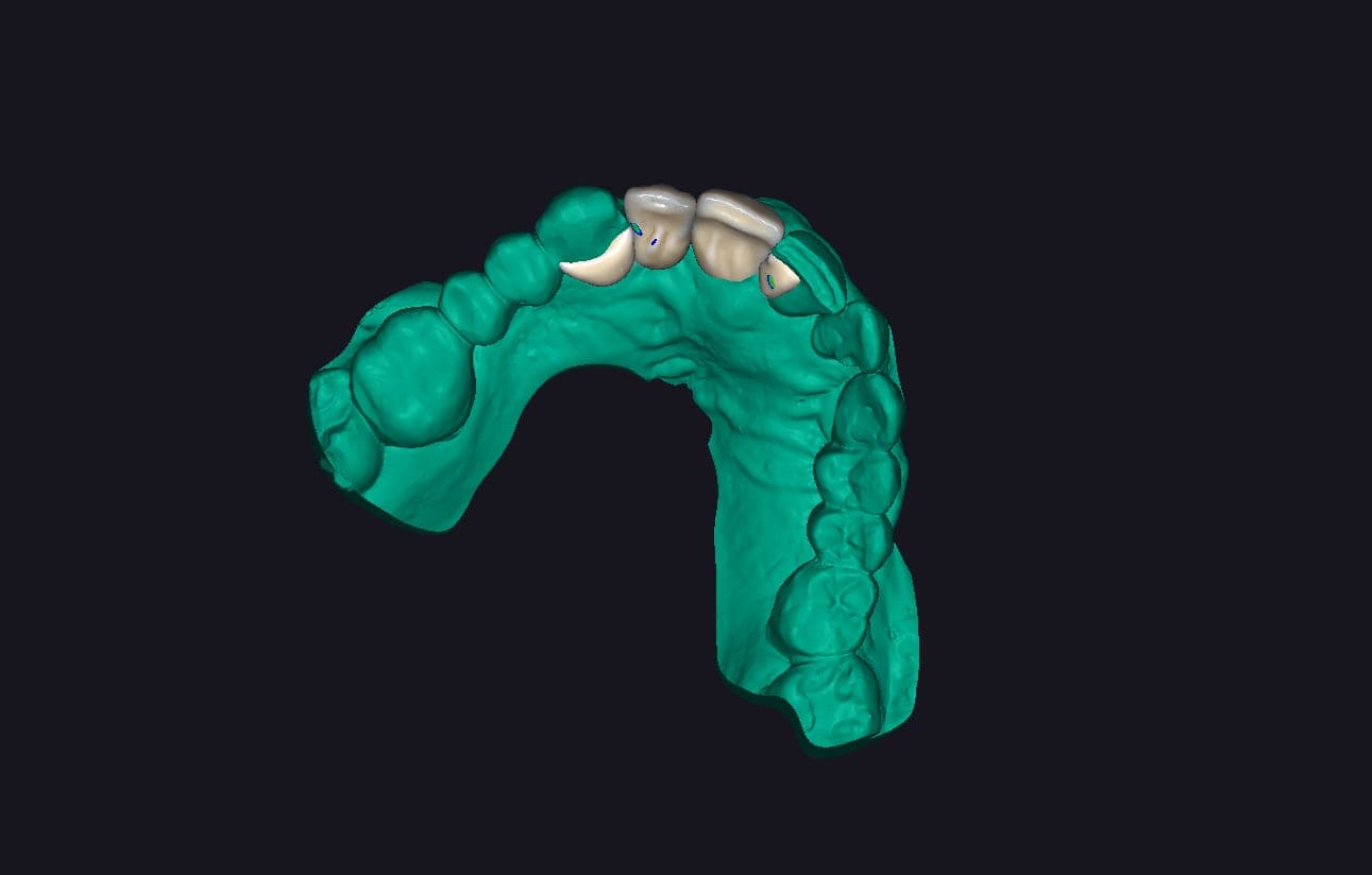 Dental CAD design and clinical technology